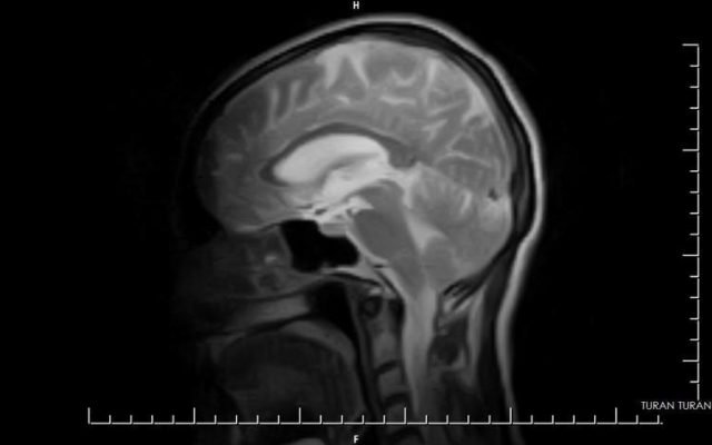 HITACHI AIRIS MATE 0.2 TESLA YOM 2007 - Image 5