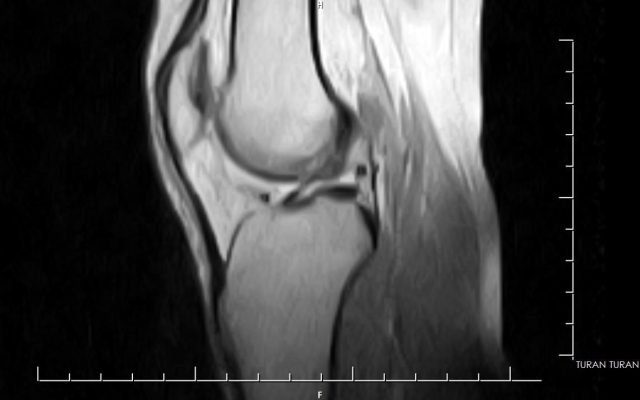 HITACHI AIRIS MATE 0.2 TESLA YOM 2007 - Image 6